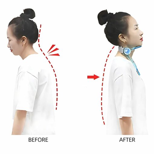 Adjustable Cervical Traction Brace – Posture Corrector Neck Collar Support Spine Stretcher Device for Pain Relief